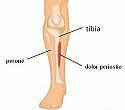 Aquell monstre invisible anomenat Periostitis Tibial